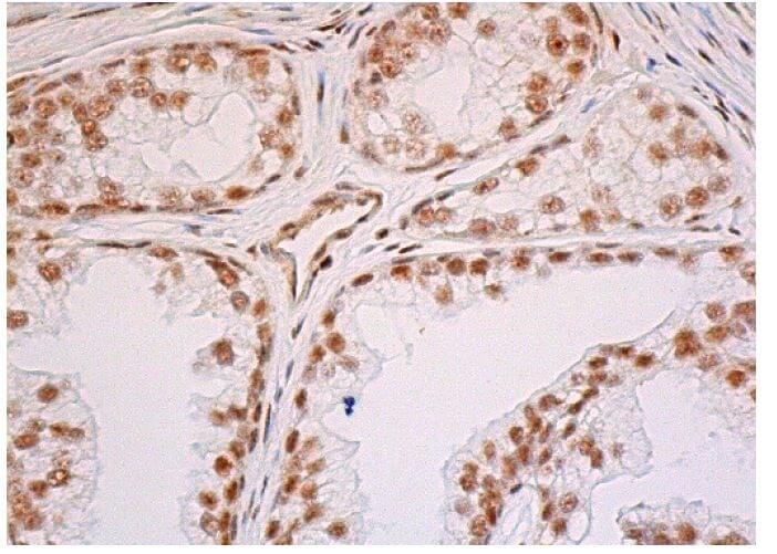 フルドド様 p-mTOR Antibody (59.Ser 2448) | SCBT - Santa Cruz Biotechnology