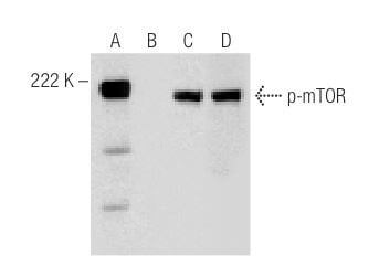 p-mtor-antibody-59-ser-2448-