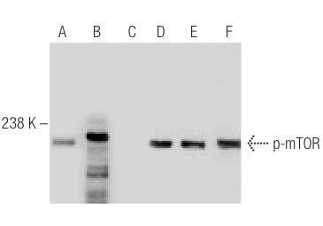 p-mtor-antibody-59-ser-2448-