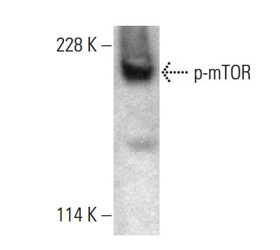 暇人（エコナントフ@ekonantf） p-mTOR Antibody (59.Ser 2448) | SCBT - Santa Cruz Biotechnology