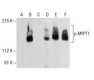p-MYPT1 Antibody (A-6) - Western Blotting - Image 285166