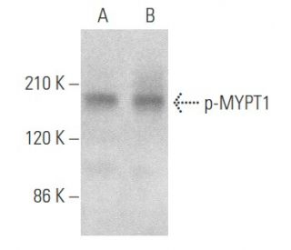western blotting image from recommended p-MYPT1 (F-11) monoclonal antibody replacement. Image 354080