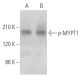 western blotting image from recommended p-MYPT1 (F-11) monoclonal antibody replacement. Image 354080
