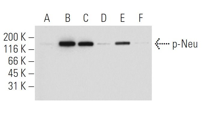 Anti P Neu Erbb2 Her2 Antibody 7f8 Scbt Santa Cruz Biotechnology