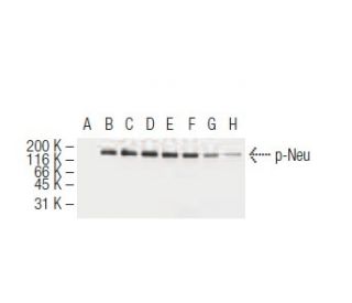 western blotting image from recommended p-ErbB2/HER2 (6G7) monoclonal antibody replacement. Image 62933