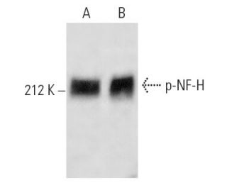 p-NF-H Antibody (7H11) - Western Blotting - Image 4411 