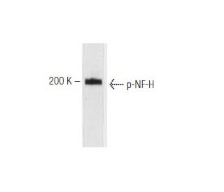 p-NF-H Antibody (NAP4) - Western Blotting - Image 67327 