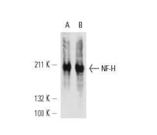 p-NF-H Antibody (NF-01) - Western Blotting - Image 12620 