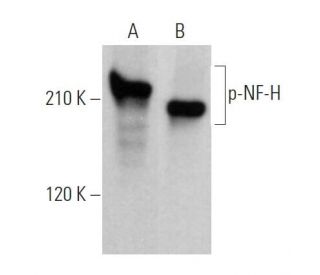 p-NF-H Antibody (RNF405) - Western Blotting - Image 362802 
