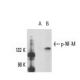 p-NF-M Antibody (RNF406) - Western Blotting - Image 11111