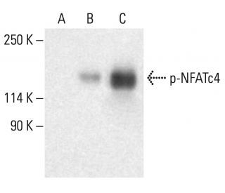 western blotting image from recommended p-NFATc4 (80.S168/170) monoclonal antibody replacement. Image 401945