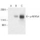 western blotting image from recommended p-NFATc4 (80.S168/170) monoclonal antibody replacement. Image 401945