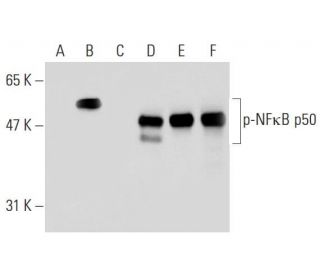 western blotting image from recommended p-NFκB p50 (A-8) monoclonal antibody replacement. Image 130261