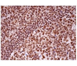 p-RELA/NFκB p65 Antibody (27.Ser 536) | SCBT - Santa Cruz