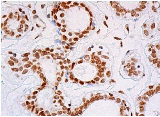 p-RELA/NFκB p65 Antibody (27.Ser 536) | SCBT - Santa Cruz