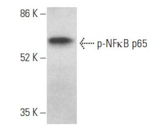 p-RELA/NFκB p65 Antibody (27.Ser 536) | SCBT - Santa Cruz