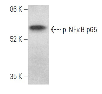 Western blots show p65 antibodies that passed the test of specificity