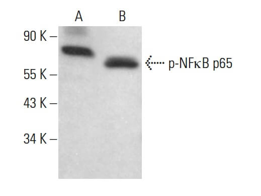 Western blots show p65 antibodies that passed the test of specificity