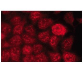 p-RELA/NF&kappa;B p65 Antibody (A-8) - Immunofluorescence - Image 134247 