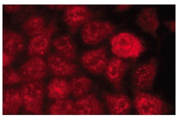 アブPROＭＡＸ3600c p-RELA/NFκB p65 Antibody (27.Ser 536) | SCBT - Santa Cruz