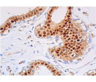 immunohistochemistry image from recommended p-RELA/NF&kappa;B p65 (A-8) monoclonal antibody replacement. Image 357862