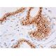 immunohistochemistry image from recommended p-RELA/NFκB p65 (A-8) monoclonal antibody replacement. Image 357862