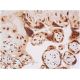 immunohistochemistry image from recommended p-RELA/NFκB p65 (27.Ser 536) monoclonal antibody replacement. Image 357860