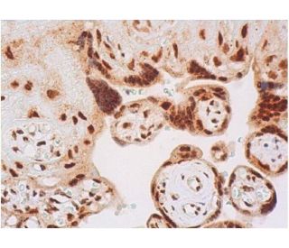 immunohistochemistry image from recommended p-RELA/NFκB p65 (27.Ser 536) monoclonal antibody replacement. Image 357860