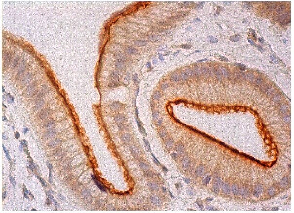 p-nhe-3-antibody-14d5-
