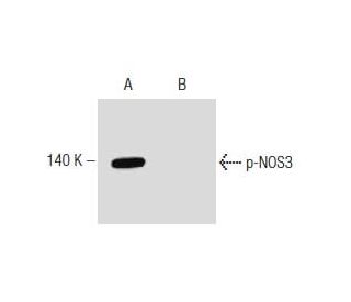 p-eNOS Antibody (pS633.37) - Western Blotting - Image 127556 