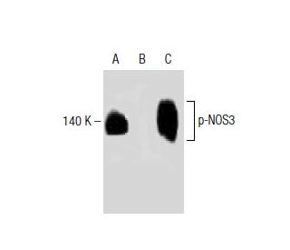 p-eNOS Antibody (pT495.33) - Western Blotting - Image 138268 