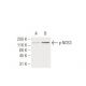 This polyclonal antibody has been discontinued. See our recommended <a href="p-nos3-antibody-15e2">p-eNOS (15E2)</a> monoclonal antibody (sample data shown). western blotting image from recommended p-eNOS (15E2) monoclonal antibody replacement. Image 62936