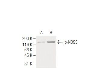 western blotting image from recommended p-eNOS (15E2) monoclonal antibody replacement. Image 62936