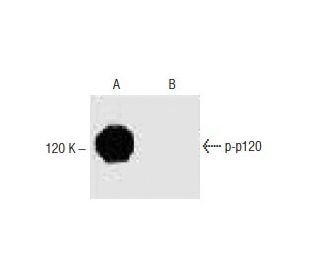 p-p120 Antibody (pS268.9A): sc-293000