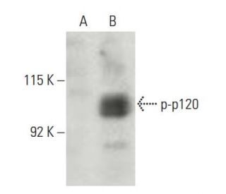p-p120 Antibody (pS268.9A) - Western Blotting - Image 397508 