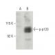 p-p120 Antibody (pS268.9A) - Western Blotting - Image 397508 