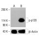p-p120 Antibody (pS268.9A) - Western Blotting - Image 414166