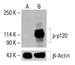 p-p120 Antibody (pS288.6A) - Western Blotting - Image 414168 