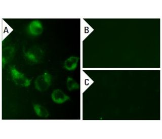 p-p120 Antibody (pT910.27) - Immunofluorescence - Image 133780 