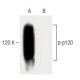 p-p120 Antibody (pY280.18) - Western Blotting - Image 60202 