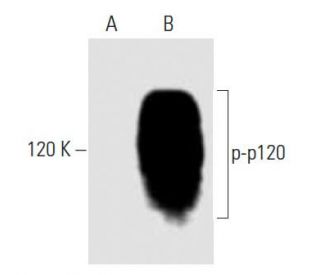 p-p120 Antibody (pY291.15A) - Western Blotting - Image 133242 
