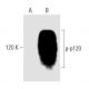 p-p120 Antibody (pY291.15A) - Western Blotting - Image 133242 