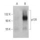 p-p120 Antibody (pY291.15A) - Western Blotting - Image 399432
