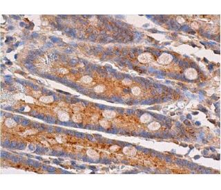 fujisusakiページ p-p38 MAPK抗体(E-1) | SCBT - Santa Cruz Biotechnology