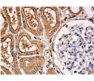 p-Src Antibody (H-3) | SCBT - Santa Cruz Biotechnology
