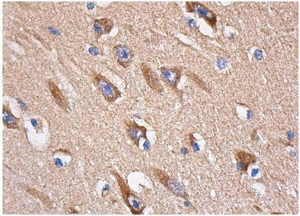 p-p38 MAPK Antibody (E-1) | SCBT - Santa Cruz Biotechnology