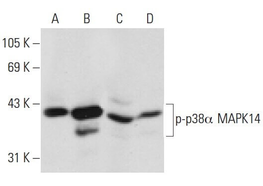 fujisusakiページ p-p38 MAPK Anticuerpo (E-1) | SCBT - Santa Cruz Biotechnology