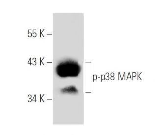 特価 p-p38-antibody-e-1-western- アイドルグッズ