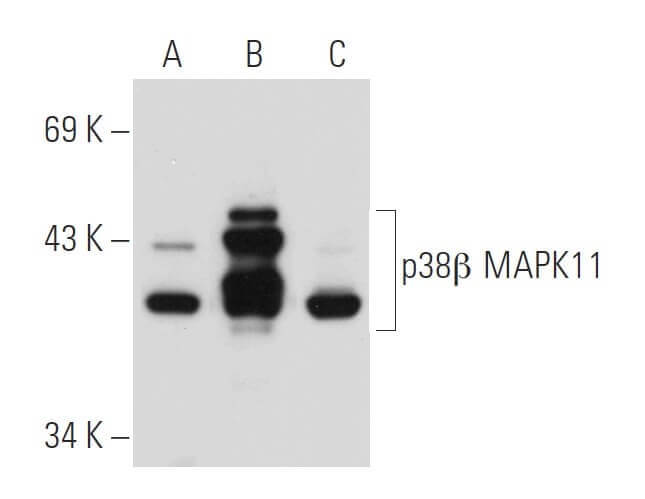 p-p38 MAPK抗体(E-1) | SCBT - Santa Cruz Biotechnology