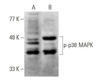 超人気新品 MAPK p-p38 Antibody Biotechnology Cruz Santa - SCBT | (E-1) 絵画